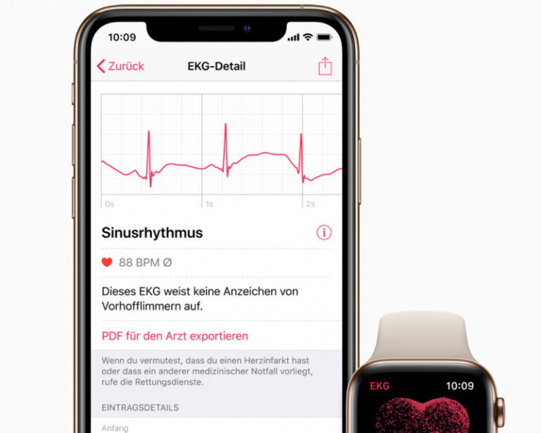 Daftar 23 Negara yang Bisa Pakai Fitur ECG di Apple Watch